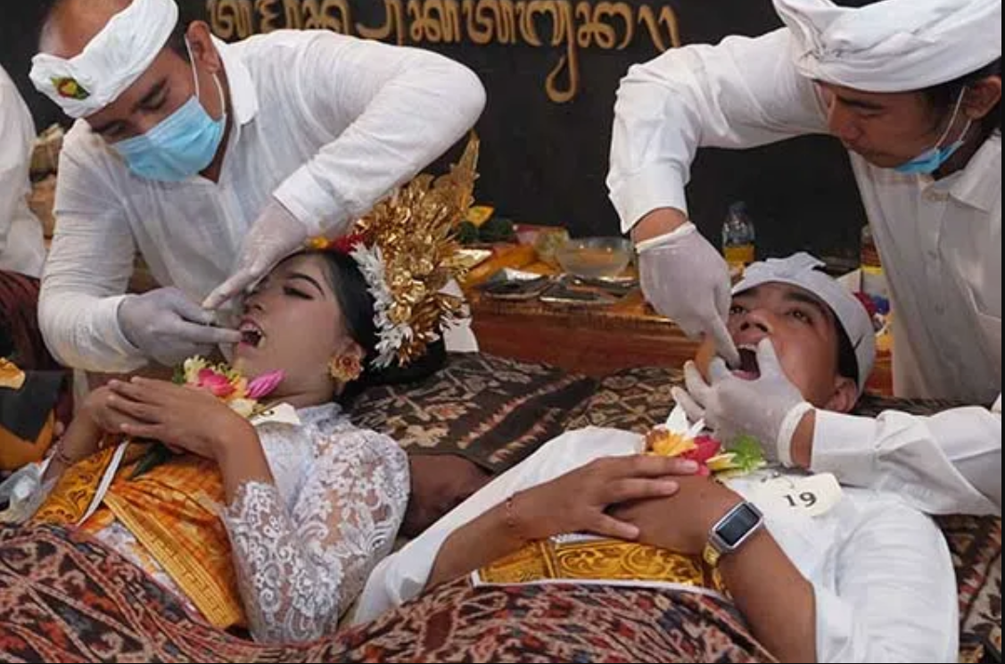 Tradisi Potong Gigi di Bali: Makna, Tujuan, dan Prosesi Sakral
